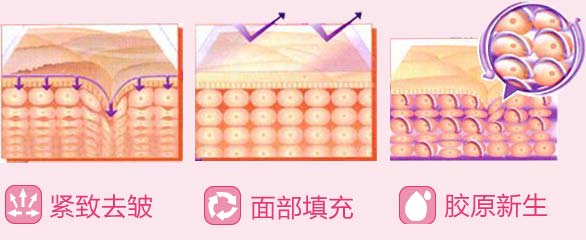 胶原蛋白作用1