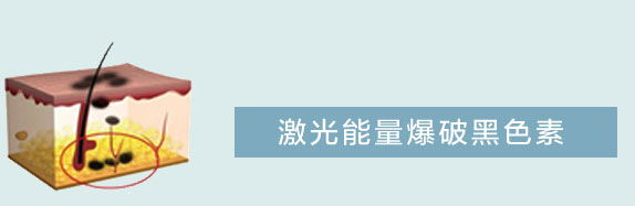 祛妊娠斑5
