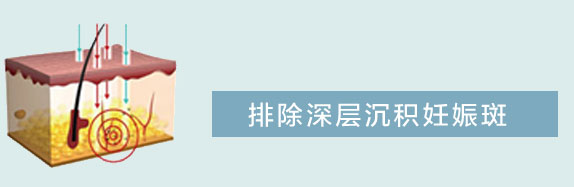 祛妊娠斑7