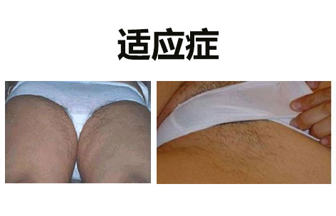 脱比基尼毛效果